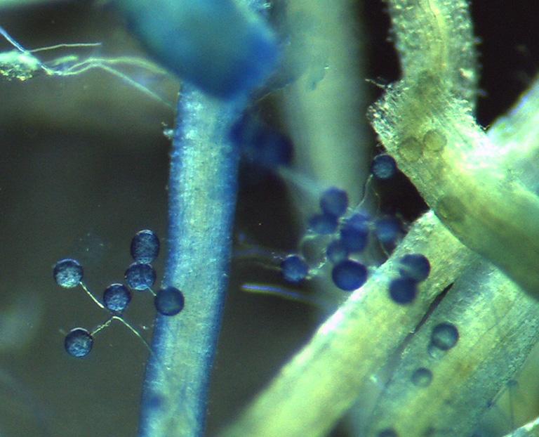 Image agrandie de micro organismes observés au microscope